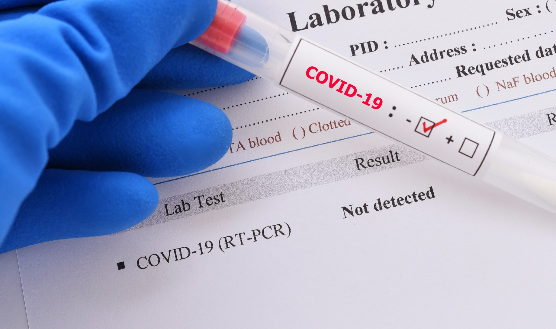 Galicia: las farmacias emitirán certificados con resultados de test COVID