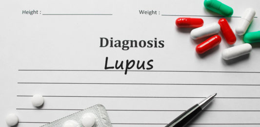 nefritis lúpica, lupus